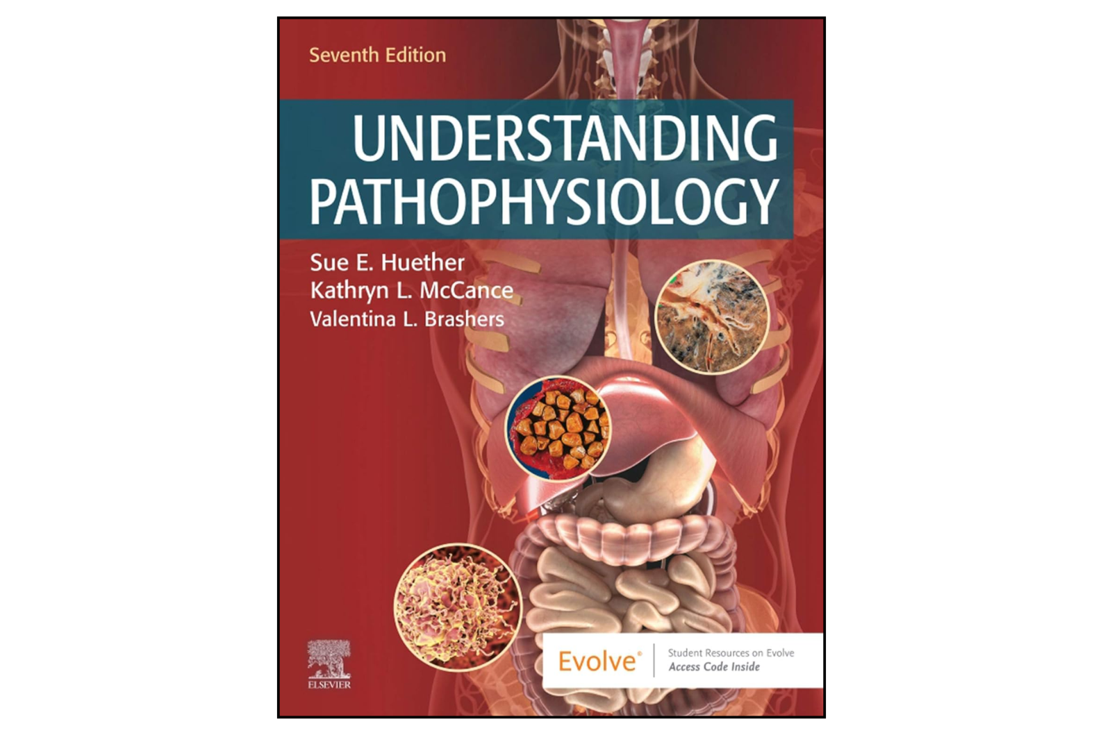 Understanding Pathophysiology (7th Edition)